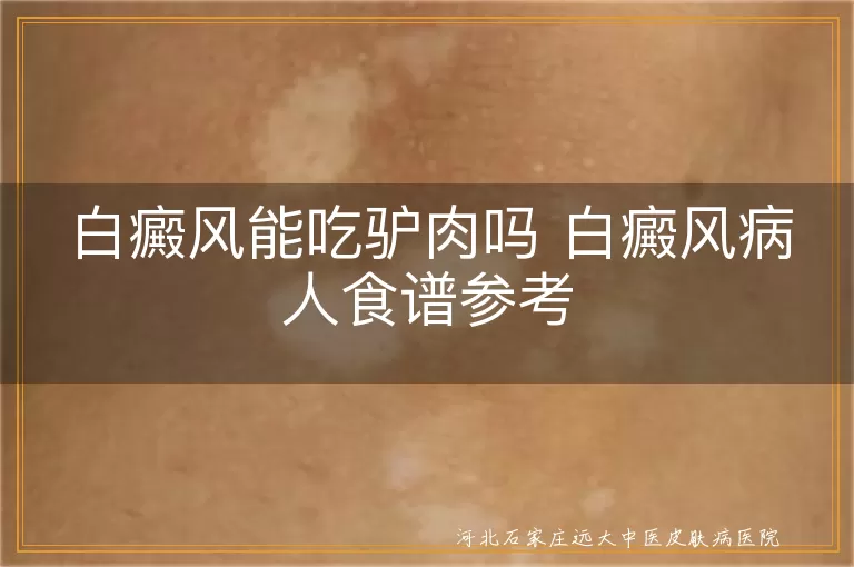 白癜风能吃驴肉吗,白癜风病人食谱,白斑吃驴肉可以吗