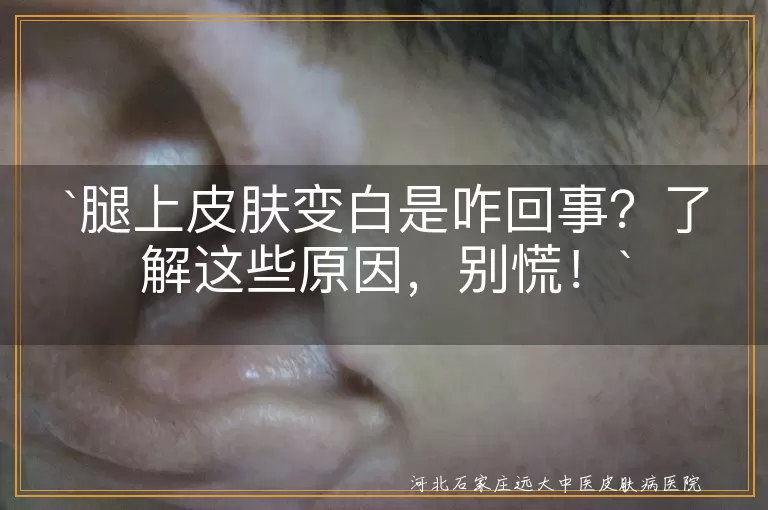 腿上皮肤变白,干燥缺水,晒伤,血液循环,皮肤炎症,白癜风,健康生活