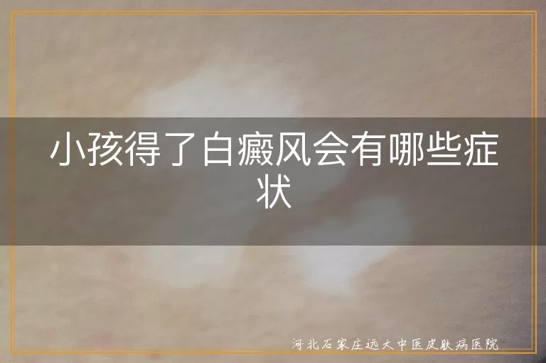 白癜风,小孩,皮肤白斑,毛发变白,黏膜受累,季节性变化,白斑面积扩大,心理健康