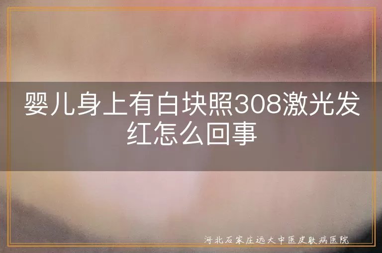 婴儿白块,308激光治疗,皮肤发红,正常现象,照射剂量,日常护理