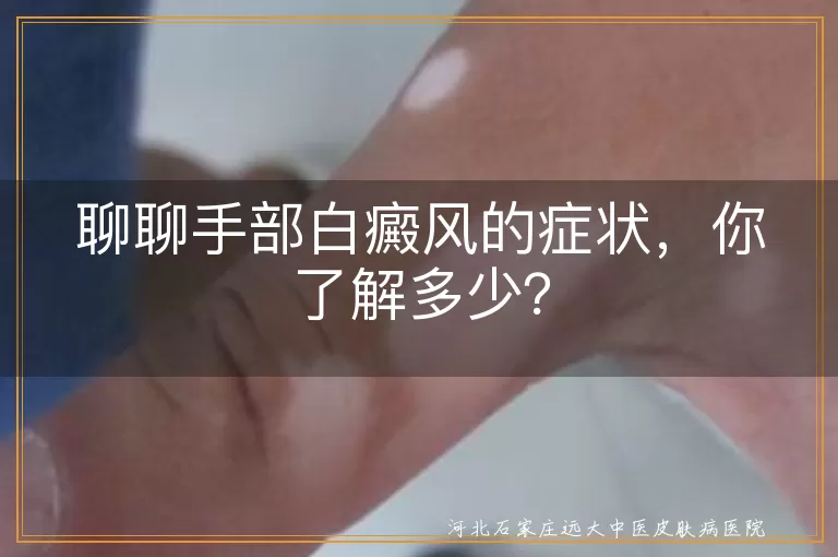 手部白癜风,症状,白斑,皮肤敏感,毛发变白,指甲变化,病情发展,判断方法