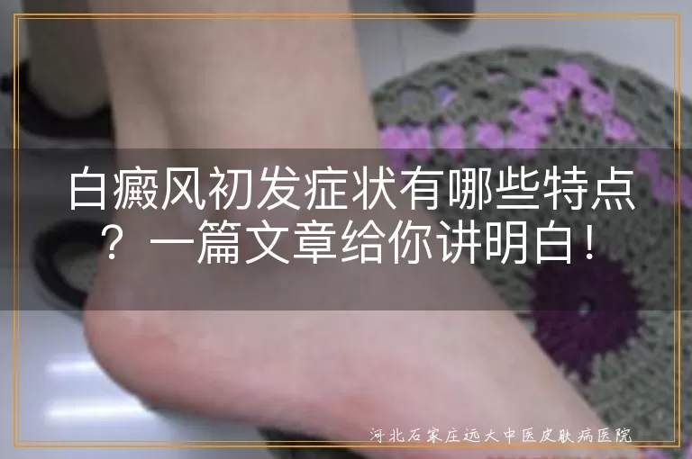 白癜风,初发症状,白斑,无痛无痒,逐渐扩散,光照敏感,伴随症状