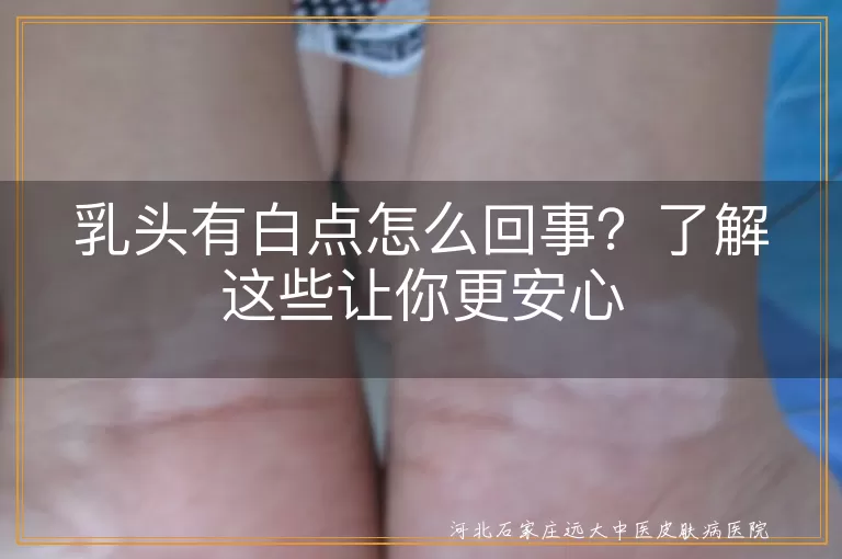 乳头白点,乳汁凝固,皮脂腺分泌物,粟丘疹,乳头炎,乳腺炎,清洁干燥,就医检查