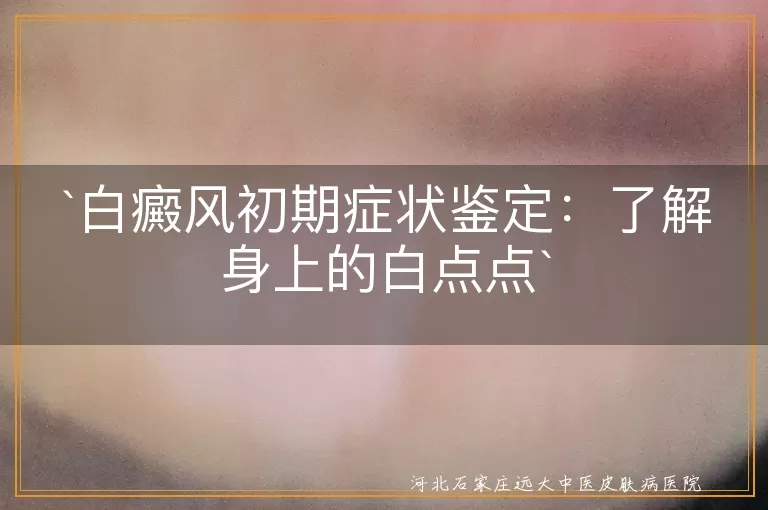 白癜风,初期症状,皮肤白点,颜色变化,形状大小,专业鉴定,药物治疗,光疗,生活习惯调整