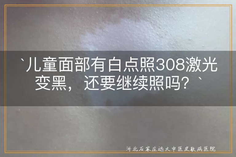 儿童面部白点,308激光治疗,变黑,继续治疗,正规医院,皮肤恢复