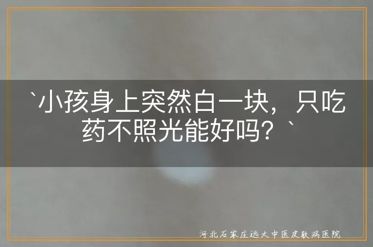 小孩白斑,白癜风,药物治疗,光疗,日常护理,耐心,综合治疗