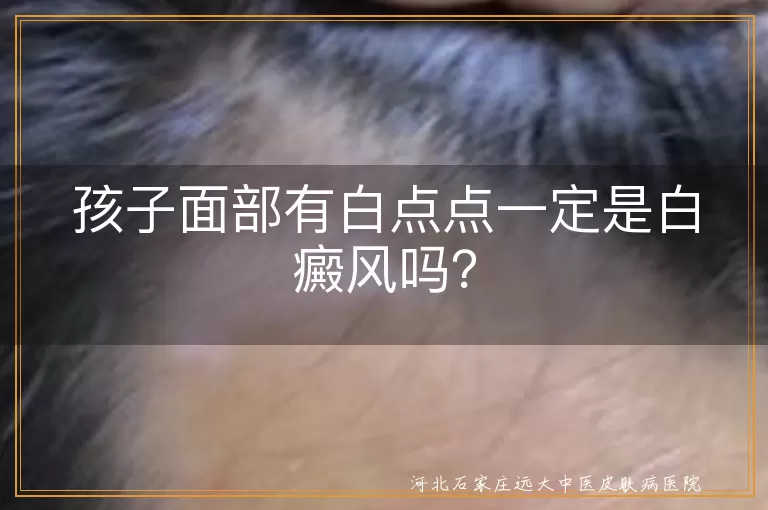 孩子面部白点点,白癜风,皮肤问题,皮脂腺分泌异常,白色糠疹,花斑癣,粟粒疹,脂肪粒,湿疹,就医检查