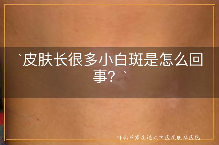 `小白斑`,`皮肤`,`紫外线伤害`,`皮肤老化`,`遗传因素`,`内分泌失调`,`皮肤疾病`,`防晒`,`均衡饮食`,`规律作息`,`专业咨询`