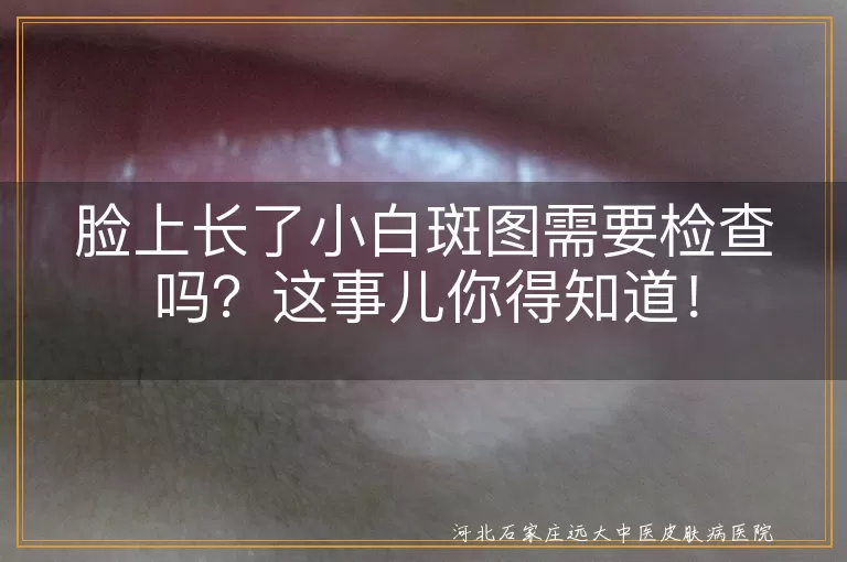 脸上白斑,晒伤,皮肤干燥,护肤品过敏,白色糠疹,皮肤科医生