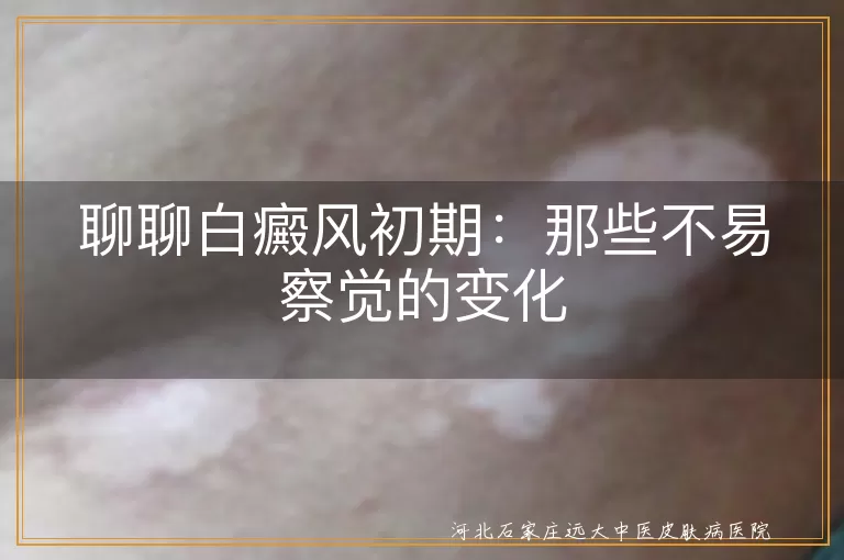 白癜风初期,皮肤变化,斑块,颜色,形状,大小,感觉,治疗