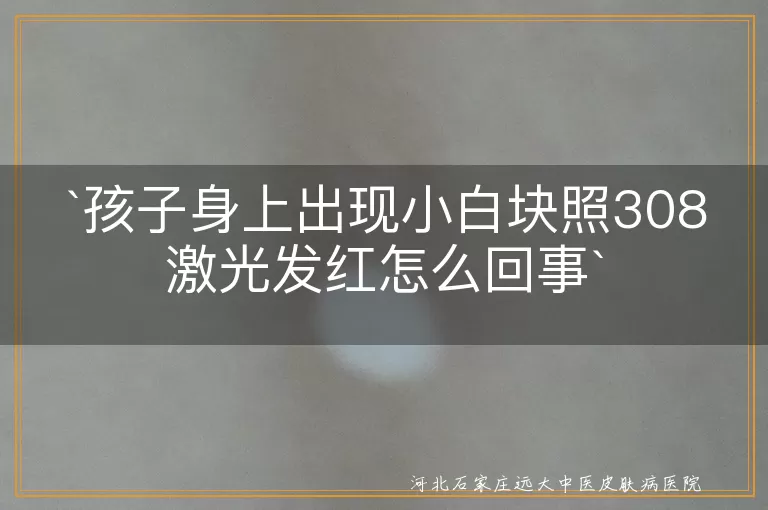 孩子,小白块,308激光治疗,发红,白癜风,剂量反应,正常反应,警惕情况