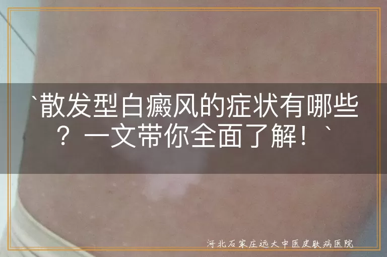 散发型白癜风,症状,白斑,分布广泛,形状不一,颜色明显,轻微瘙痒,逐渐扩大,治疗,预防