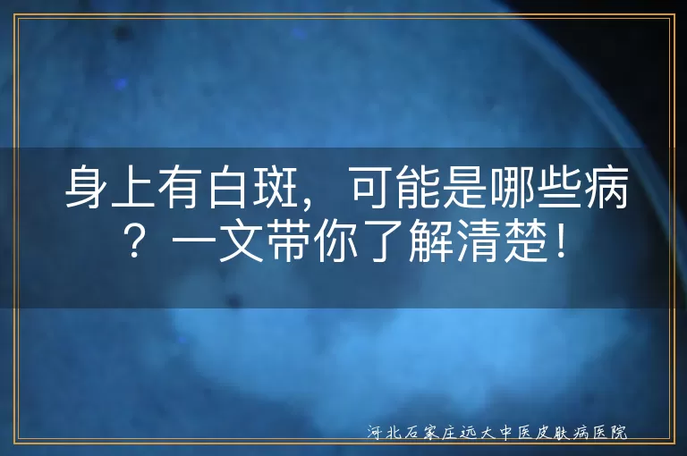 白斑,白癜风,花斑癣,贫血痣,无色素痣,炎症后色素减退,特发性点状白斑