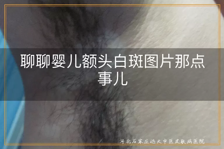 婴儿额头白斑,生理现象,皮肤问题,清洁,适时就医