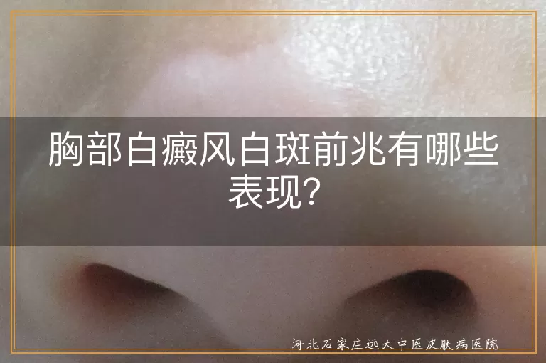 胸部白癜风,白斑前兆,色素脱失,皮肤感觉变化,白斑扩大,边缘清晰,形状不规则,数量增多,颜色变化