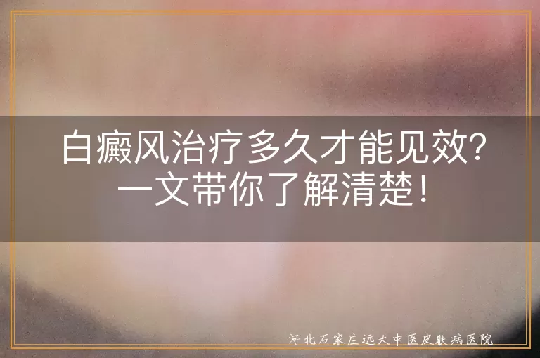 白癜风,治疗见效时间,病情严重程度,治疗方法,个体差异,生活习惯,心态,积极配合治疗