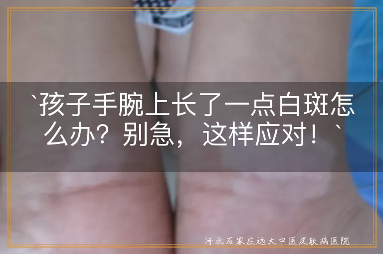 `孩子手腕白斑`,`观察变化`,`温和护理`,`专业咨询`,`保持好心态`