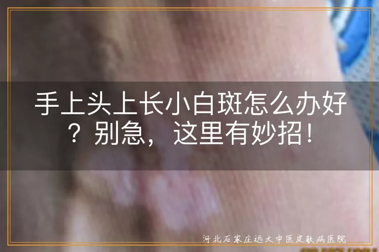 小白斑,皮肤干燥,晒伤,老化,皮肤疾病,保湿,防晒,看医生,药膏,光疗,吃药,预防