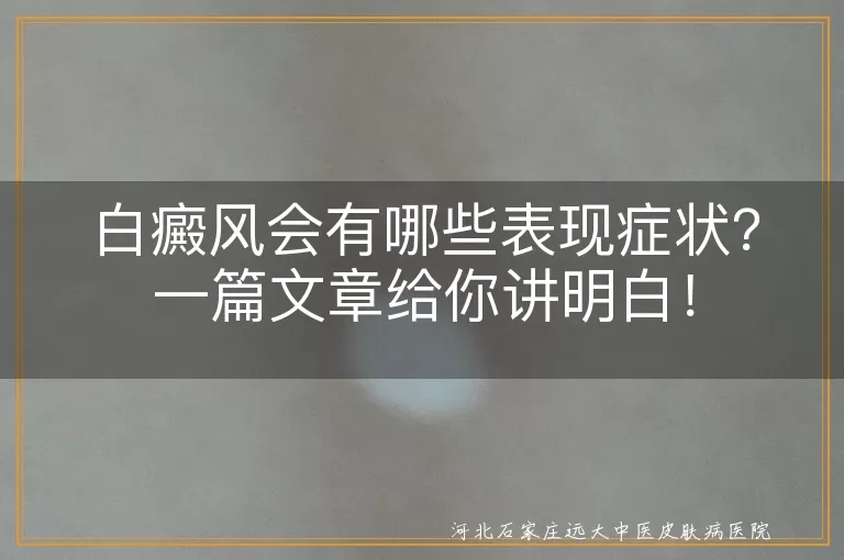 白癜风,白斑,扩散,敏感,伴随症状,心理影响,诊断,鉴别