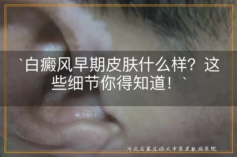 白癜风,早期症状,皮肤变化,颜色,形状,大小,感觉变化,扩散,治疗