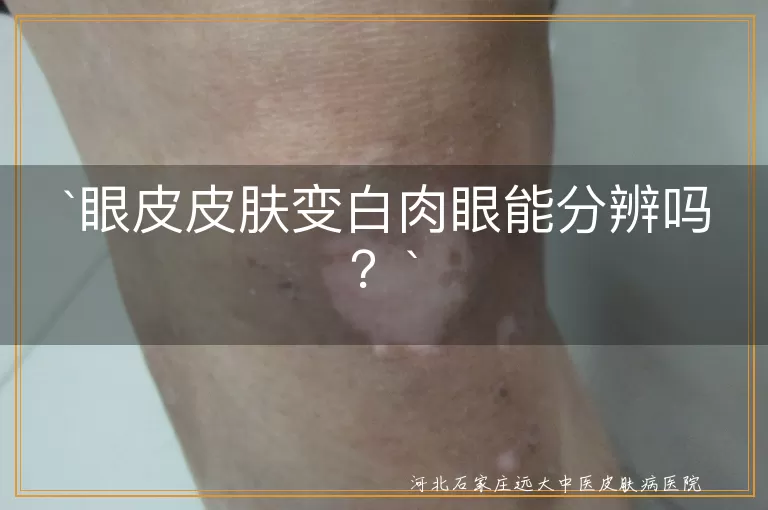 眼皮皮肤变白,肉眼分辨,生活习惯,眼部保养,专业意见
