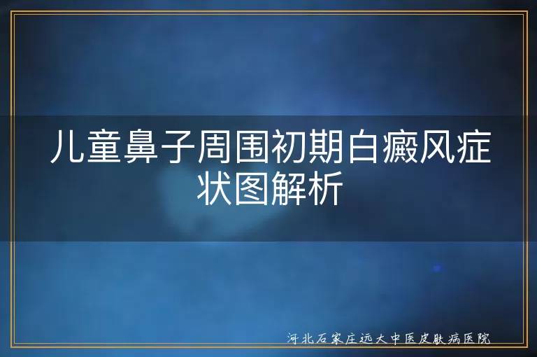 儿童白癜风,鼻子周围,初期症状,色素减退,白斑,边界模糊,及时就医