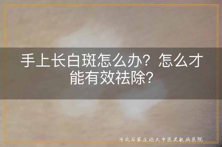 手上长白斑,祛除方法,保护皮肤,营养均衡,专业治疗,小妙招,注意事项