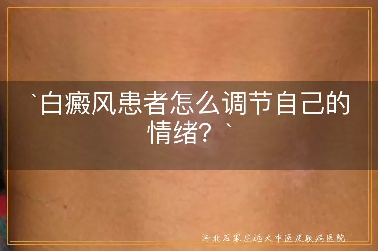 白癜风,情绪调节,接纳自我,寻求支持,兴趣爱好,健康生活方式,放松技巧,乐观心态