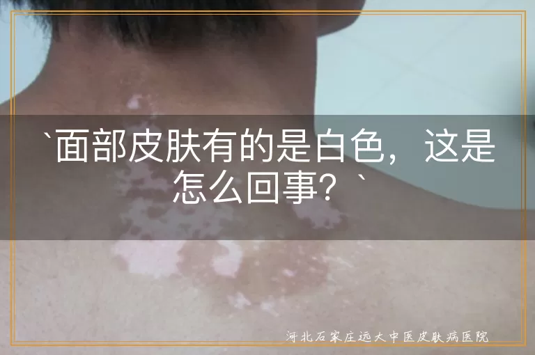 面部皮肤,白色,遗传因素,营养不良,贫血,皮肤疾病,环境因素,生活习惯,对症治疗