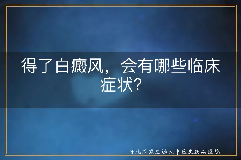 白癜风,临床症状,白斑,扩散,敏感,毛发变白,心理影响
