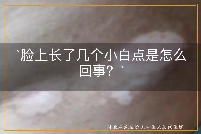 `小白点`,`脂肪粒`,`白头粉刺`,`粟丘疹`,`汗管瘤`,`皮肤清洁`,`内分泌失调`,`皮肤老化`,`遗传因素`,`预防`