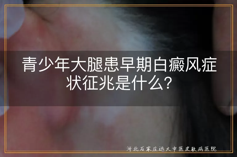 青少年,大腿,白癜风,早期症状,白斑,边缘清晰,表面光滑,感觉正常,对日光敏感,扩散