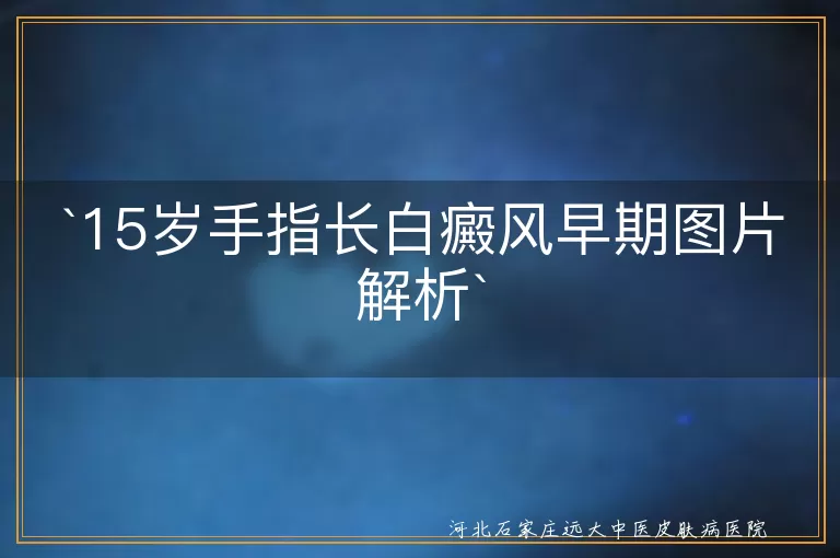 白癜风,手指,早期症状,图片,治疗,预防,青少年