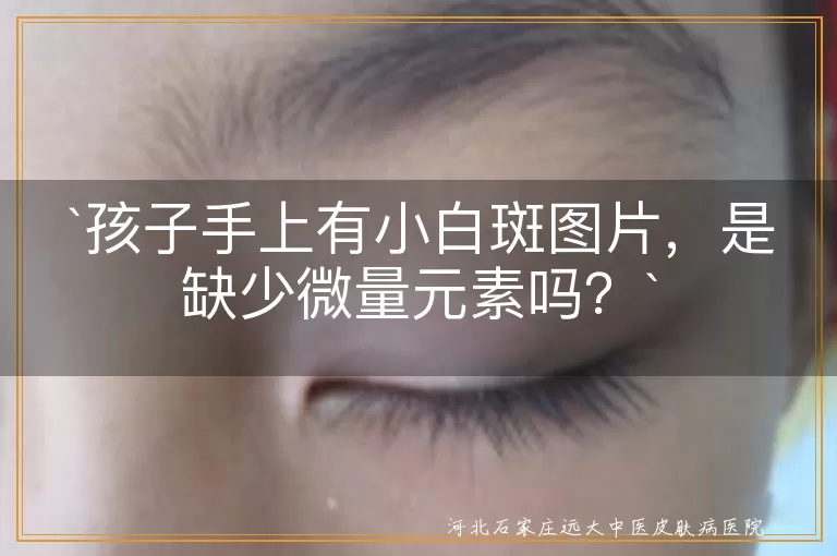 `小白斑`,`微量元素`,`孩子`,`皮肤干燥`,`长时间泡水`,`晒伤`,`食欲不振`,`贫血`