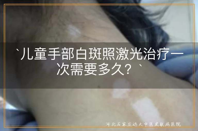 儿童手部白斑,激光治疗,治疗时间,病情严重程度,治疗方案,照光剂量,日常护理
