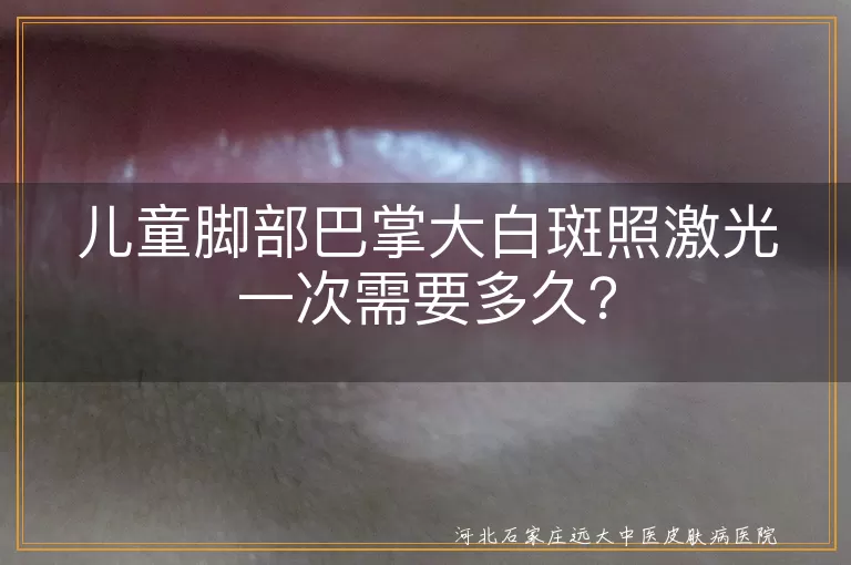 儿童脚部白斑,激光治疗,治疗时间,治疗周期,家长配合,日常护理,心理关怀