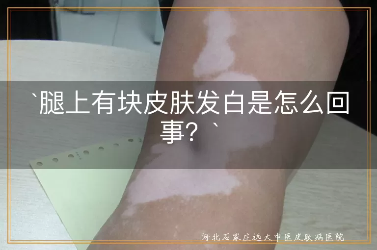 `腿上皮肤发白`,`皮肤干燥`,`色素变化`,`贫血`,`血液循环`,`皮肤病`,`遗传因素`