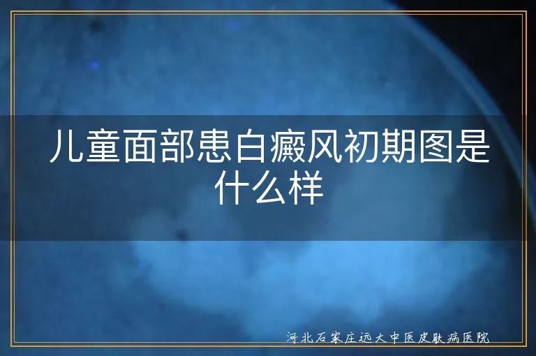 儿童面部,白癜风,初期症状,颜色变浅,界限模糊,面积小,专业检查,日常护理,心理健康
