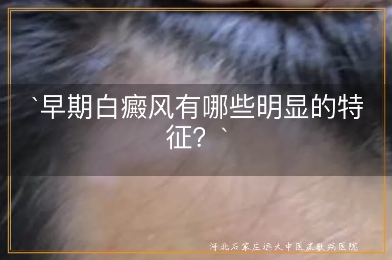 `白癜风,早期特征,白斑,光敏感,逐渐扩大,表面光滑,轻微瘙痒,边缘色素沉着,精神压力`