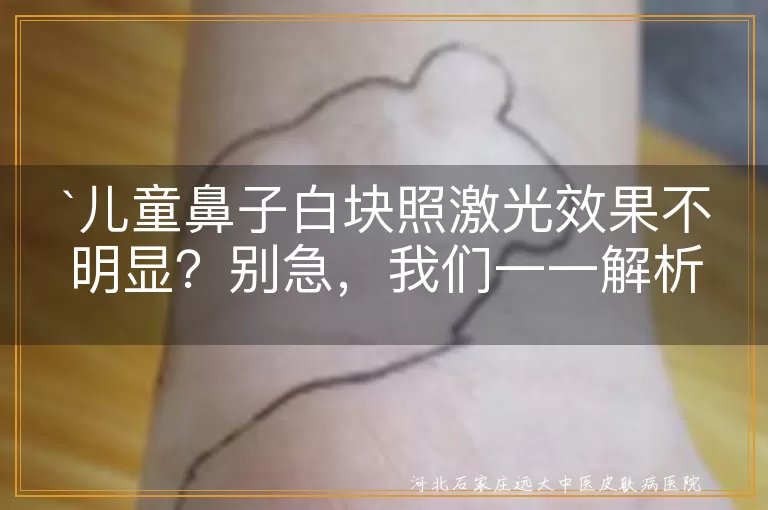 儿童鼻子白块,激光治疗,效果不明显,诊断明确,调整治疗方案,日常护理,预防工作