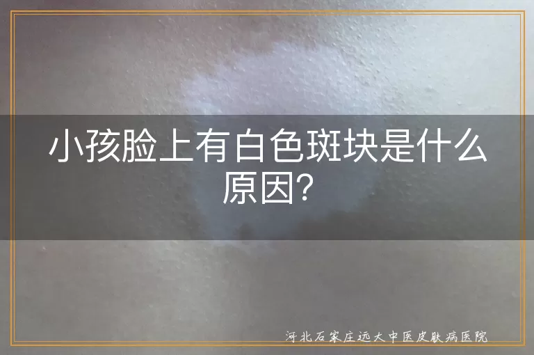 小孩,白色斑块,色素沉着不均,维生素缺乏,皮肤病,白癜风,就医检查