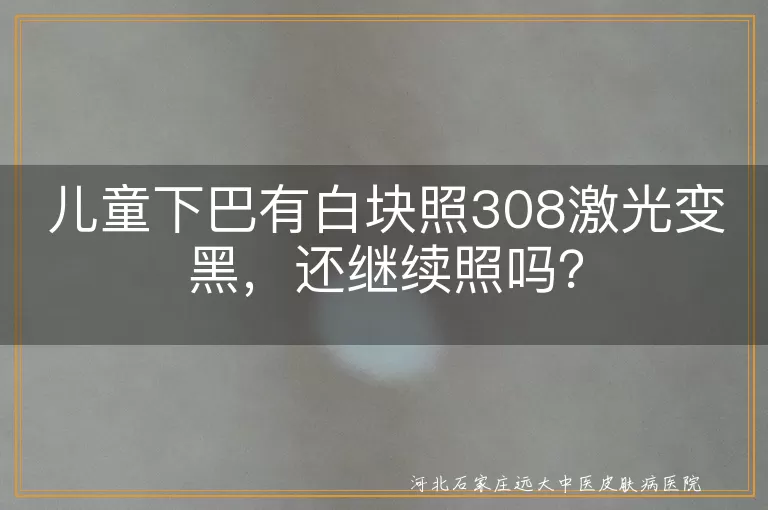儿童下巴白块,308激光治疗,变黑,继续照射,正规医院,护理