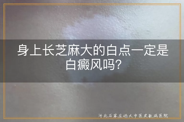 小白点,白癜风,单纯糠疹,花斑糠疹,无色素痣,老年性白斑,皮肤科,专业诊断,治疗方案