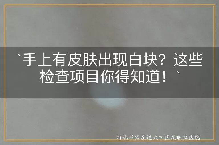 手上皮肤白块,皮肤科医生,伍德灯检查,皮肤镜检查,组织病理检查,血液检查,对症治疗