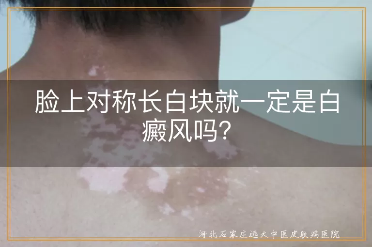 脸上白块,白癜风,皮肤病,贫血痣,白色糠疹,花斑癣,炎症后色素减退,就医检查