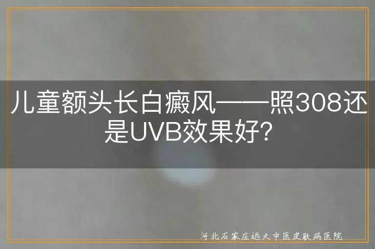 儿童白癜风,308nm准分子激光治疗,UVB光疗,治疗效果,个性化治疗,专业医生指导