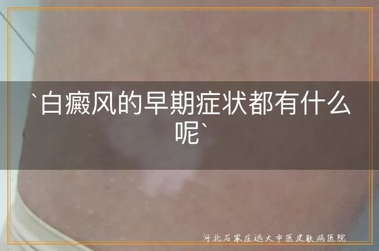 白癜风,早期症状,白斑,形状不规则,边缘清晰,阳光敏感,逐渐扩大,伴随症状