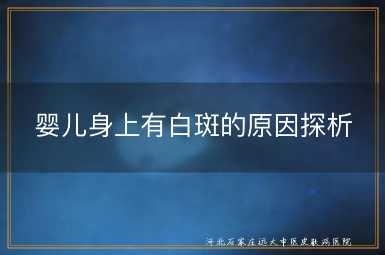 婴儿白斑,遗传因素,维生素缺乏,皮肤真菌感染,紫外线照射,白色糠疹,无色素痣,贫血痣,白癜风