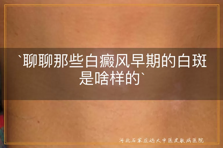 白癜风早期,白斑颜色,白斑形状,白斑大小,白斑分布,白斑变化,预防,护理