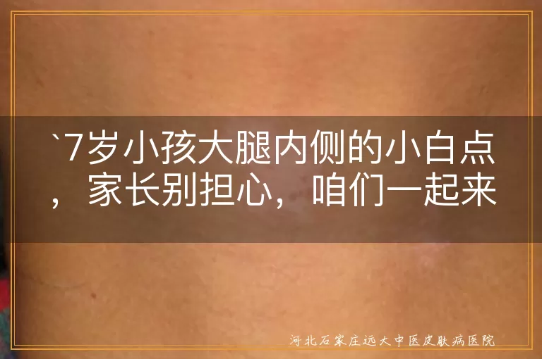 7岁小孩,大腿内侧,小白点,皮肤干燥,轻微皮炎,色素沉着不均,看医生